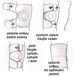 obsah01-Knee - wearing instructions orthesis .jpg